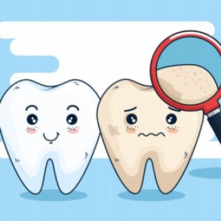 全方位牙周護理治療